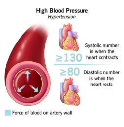 BLOOD PRESSURE | GS Paper 3 | Science and Technology_2