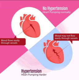 BLOOD PRESSURE | GS Paper 3 | Science and Technology-1